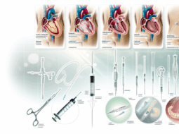Comprehensive List of Invasive Procedures Explained